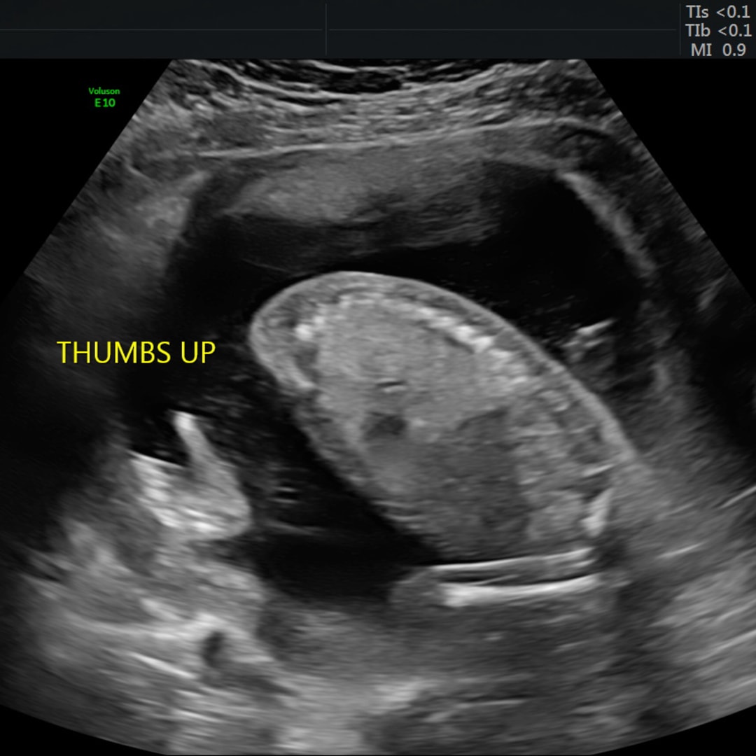 Photo shared by Emily for their Babylist baby registry.