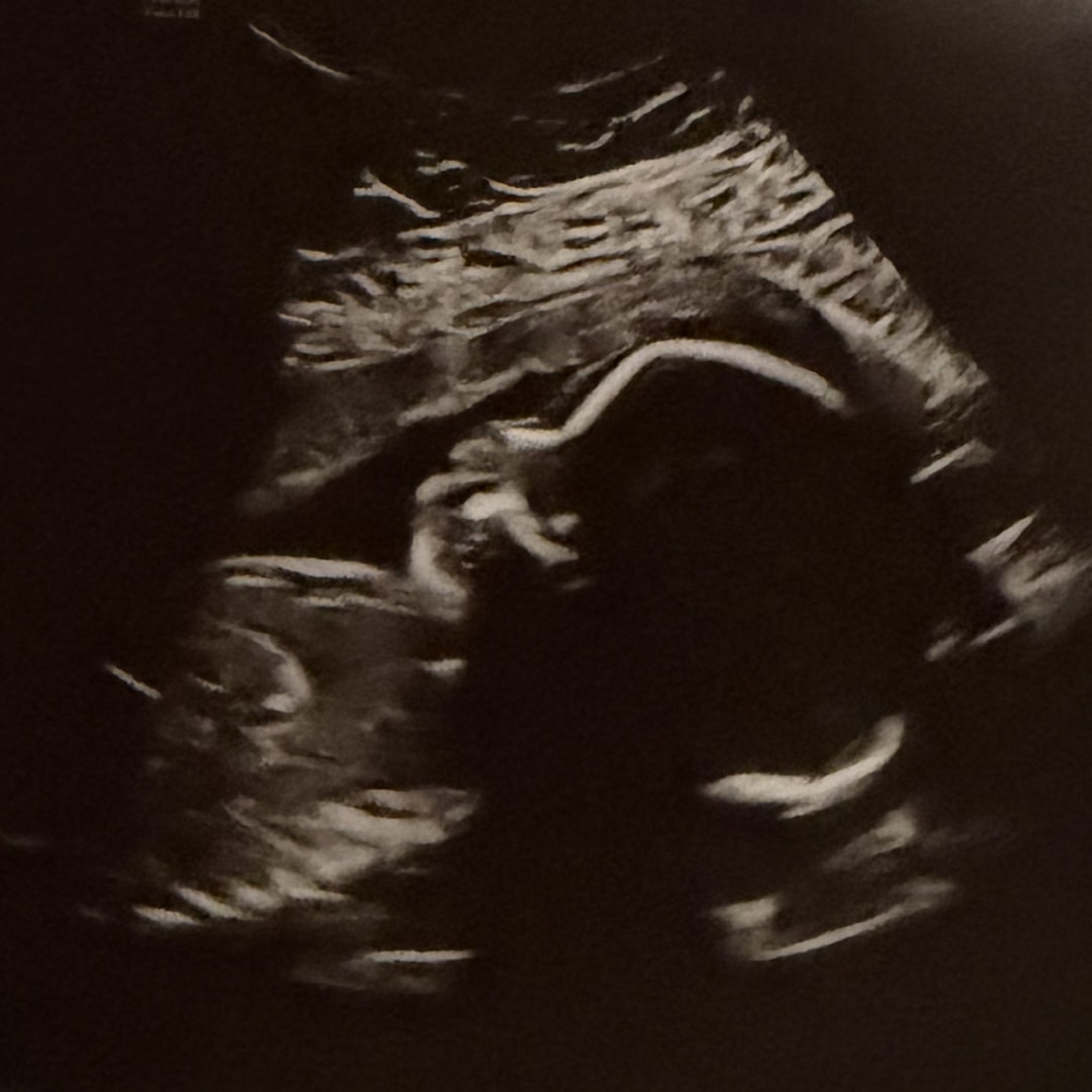 Photo shared by Elaine for their Babylist baby registry.