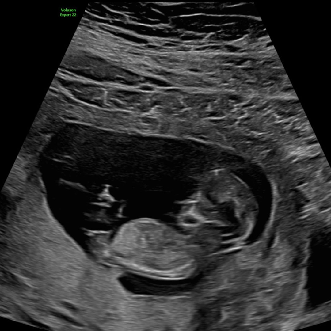 Photo shared by Briauna for their Babylist baby registry.