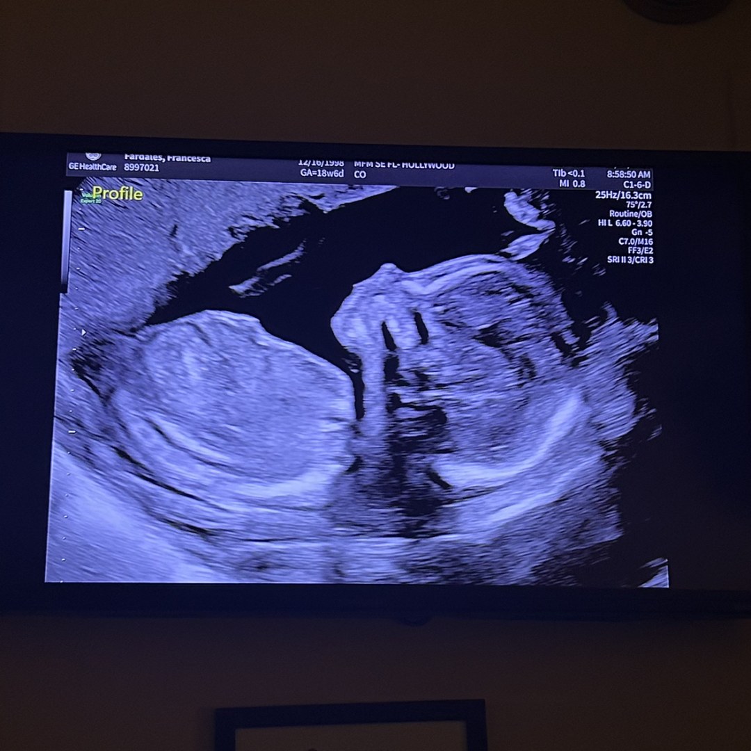 Photo shared by Francesca for their Babylist baby registry.