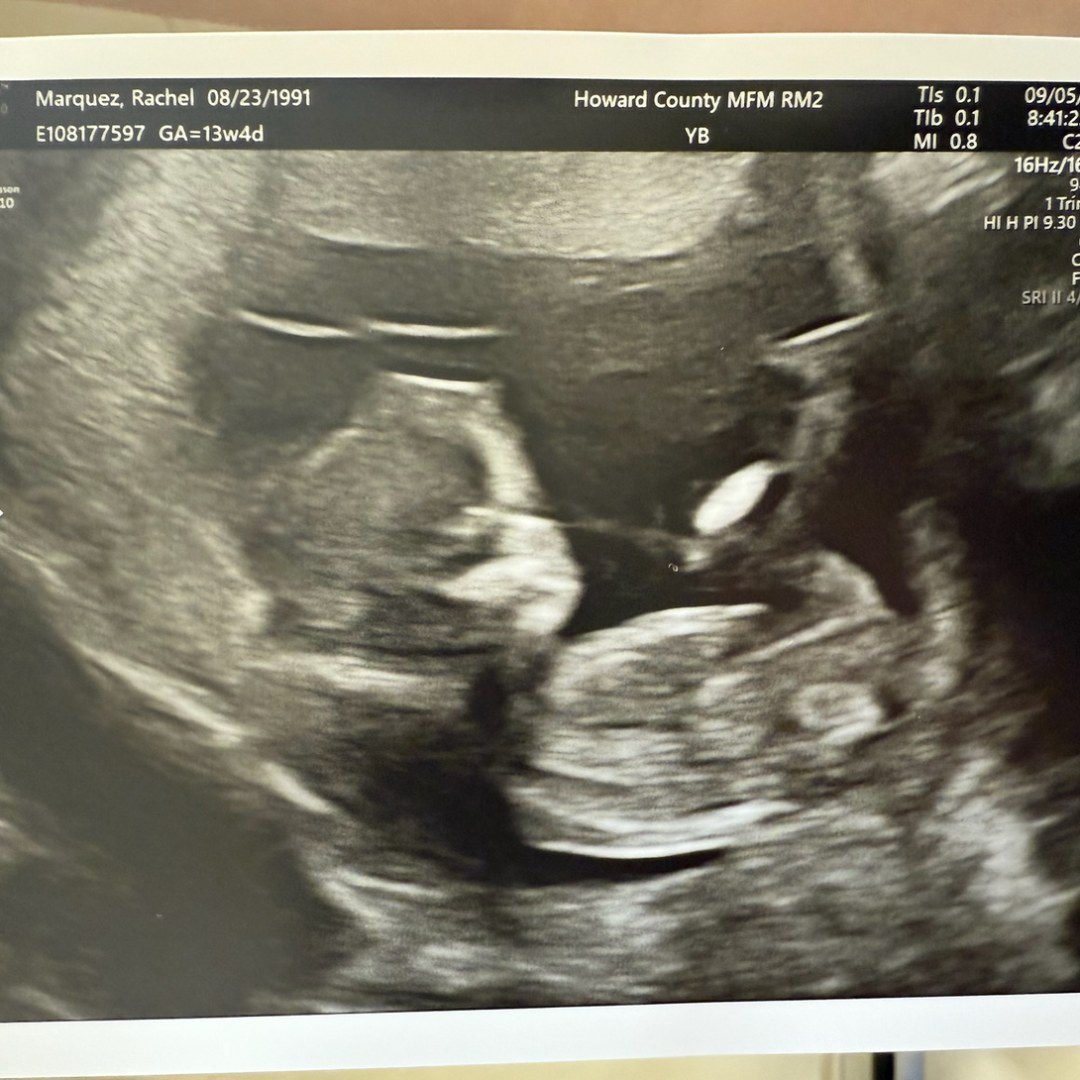 Photo shared by Rachel for their Babylist baby registry.