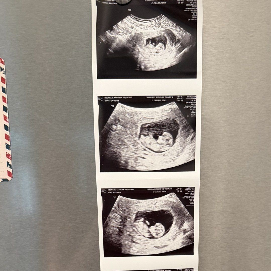 Photo shared by Kathleen for their Babylist baby registry.