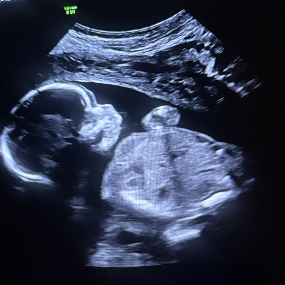Photo shared by Raeannah for their Babylist baby registry.