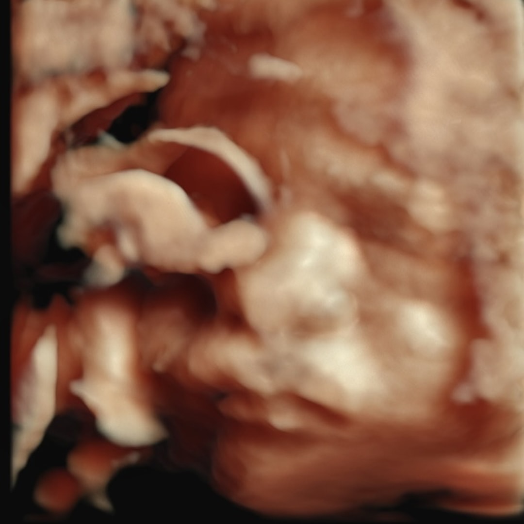 Photo shared by Kristin for their Babylist baby registry.