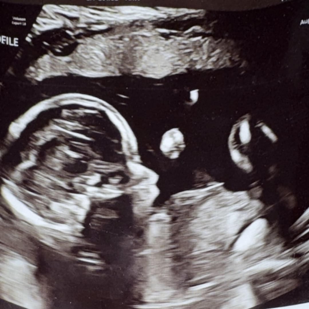 Photo shared by Helen for their Babylist baby registry.