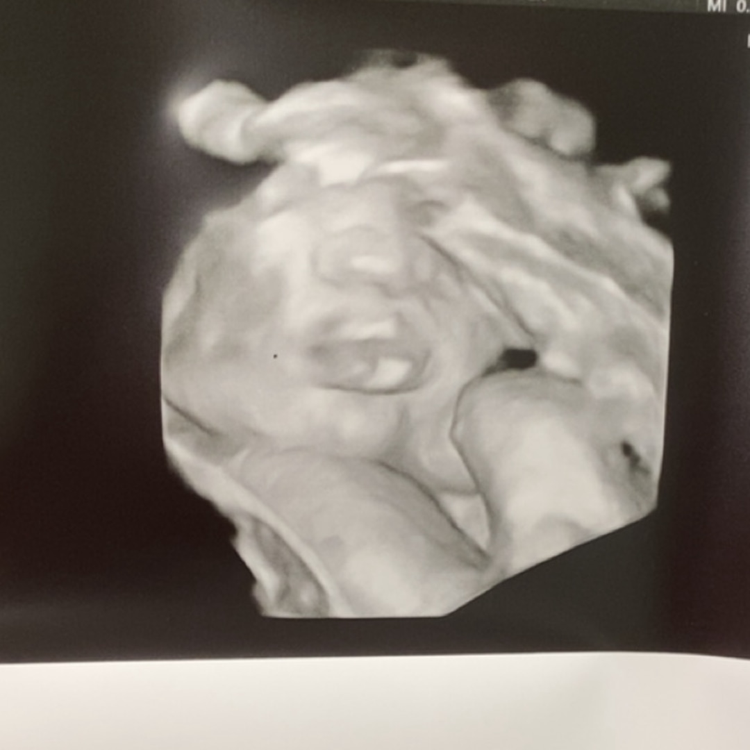 Photo shared by Brianna for their Babylist baby registry.
