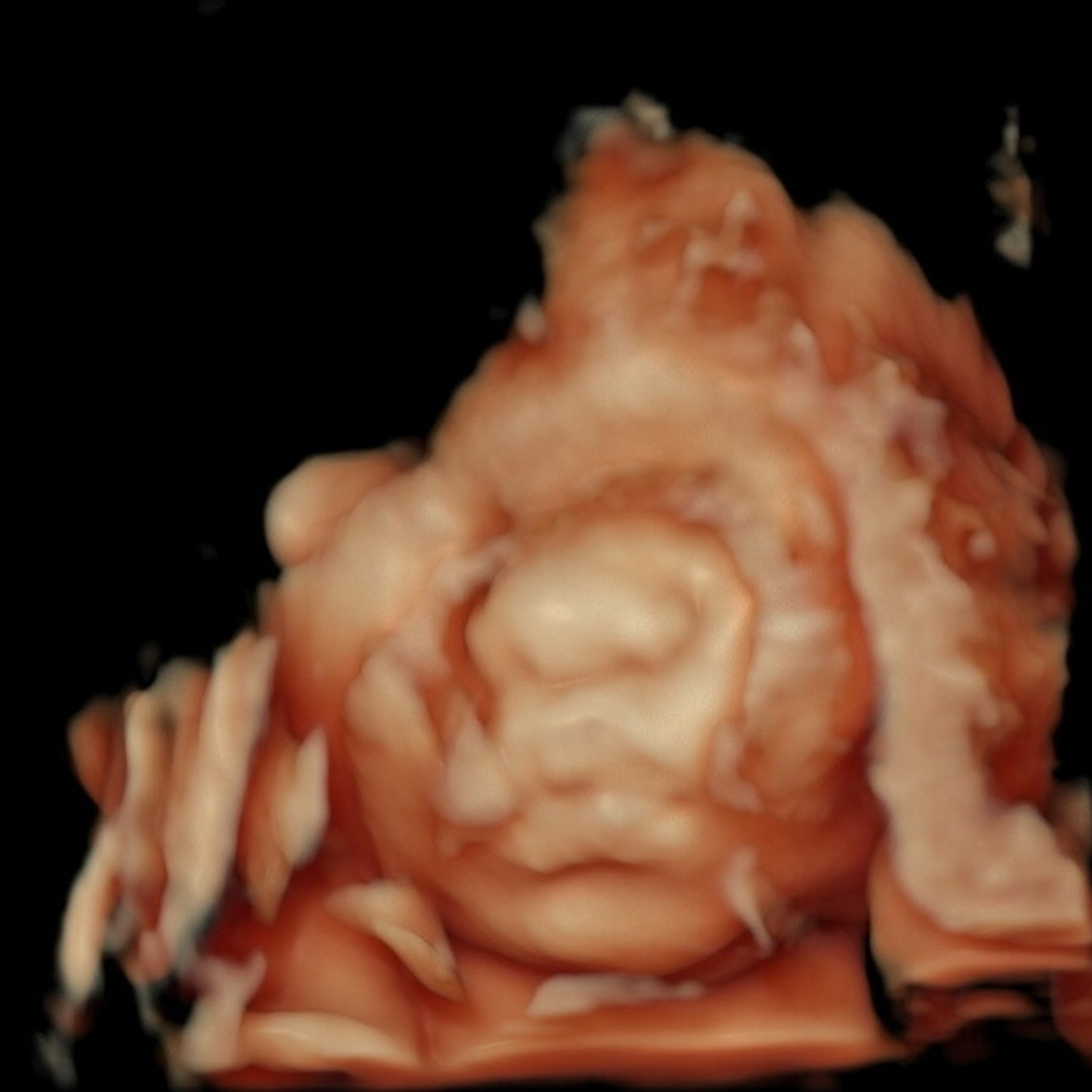 Photo shared by Abigail for their Babylist baby registry.