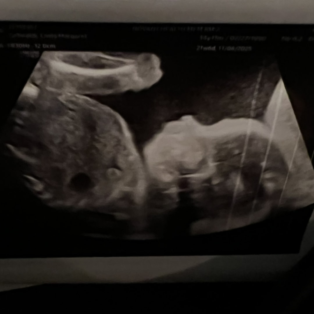 Photo shared by Emily for their Babylist baby registry.