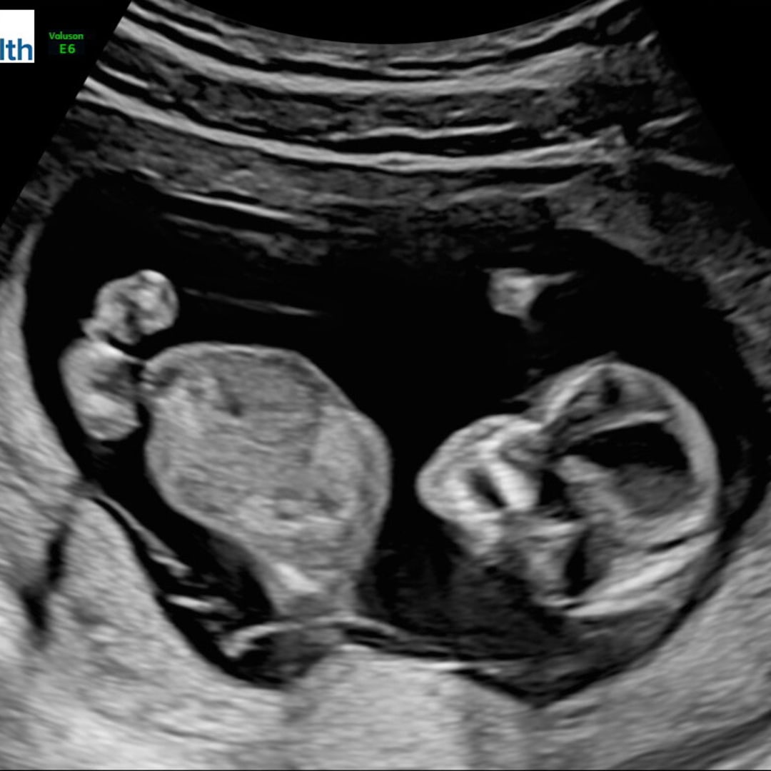 Photo shared by Amber for their Babylist baby registry.