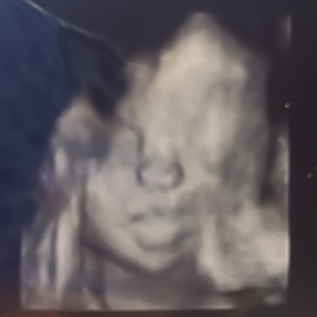 Photo shared by Caitlin for their Babylist baby registry.