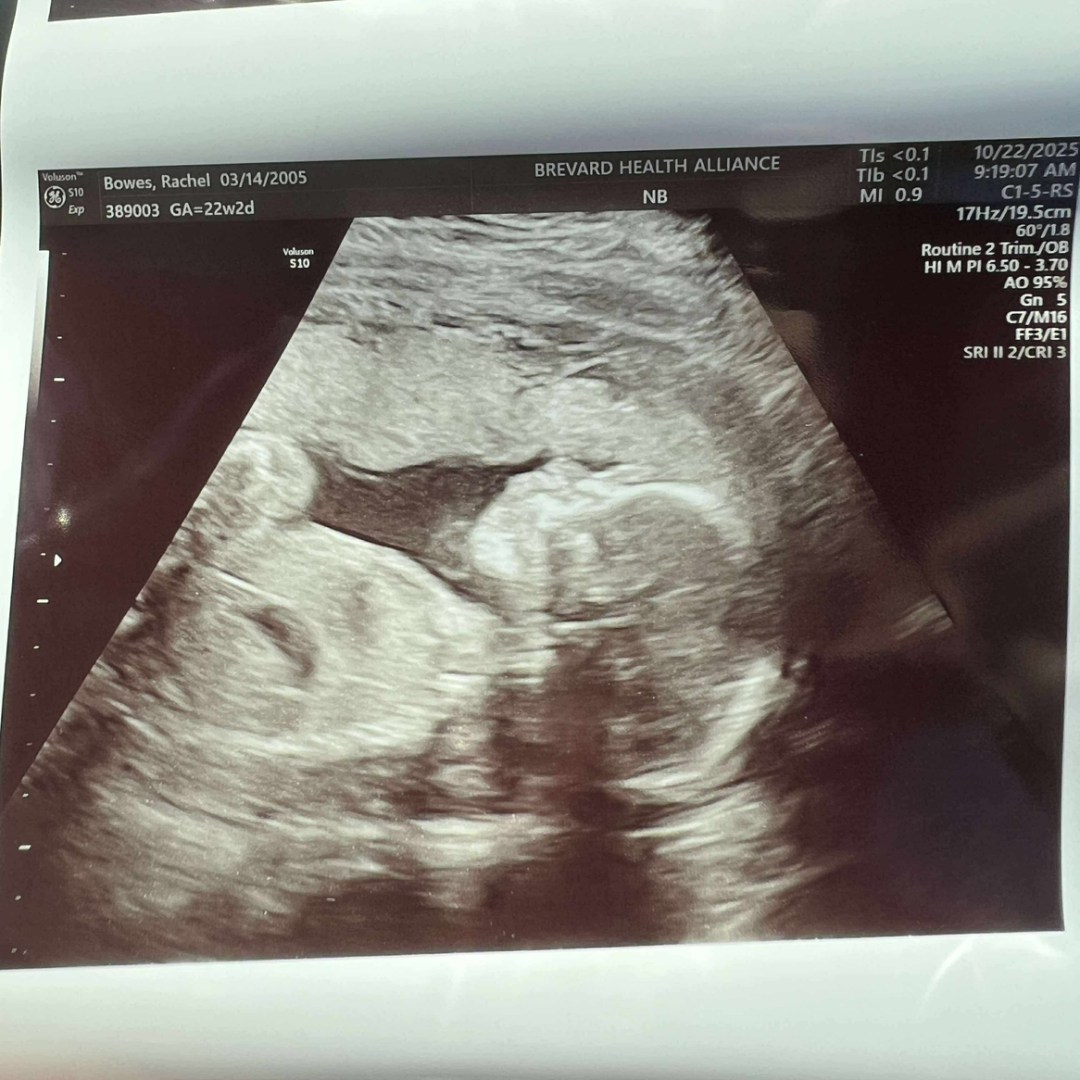 Photo shared by Rachel for their Babylist baby registry.