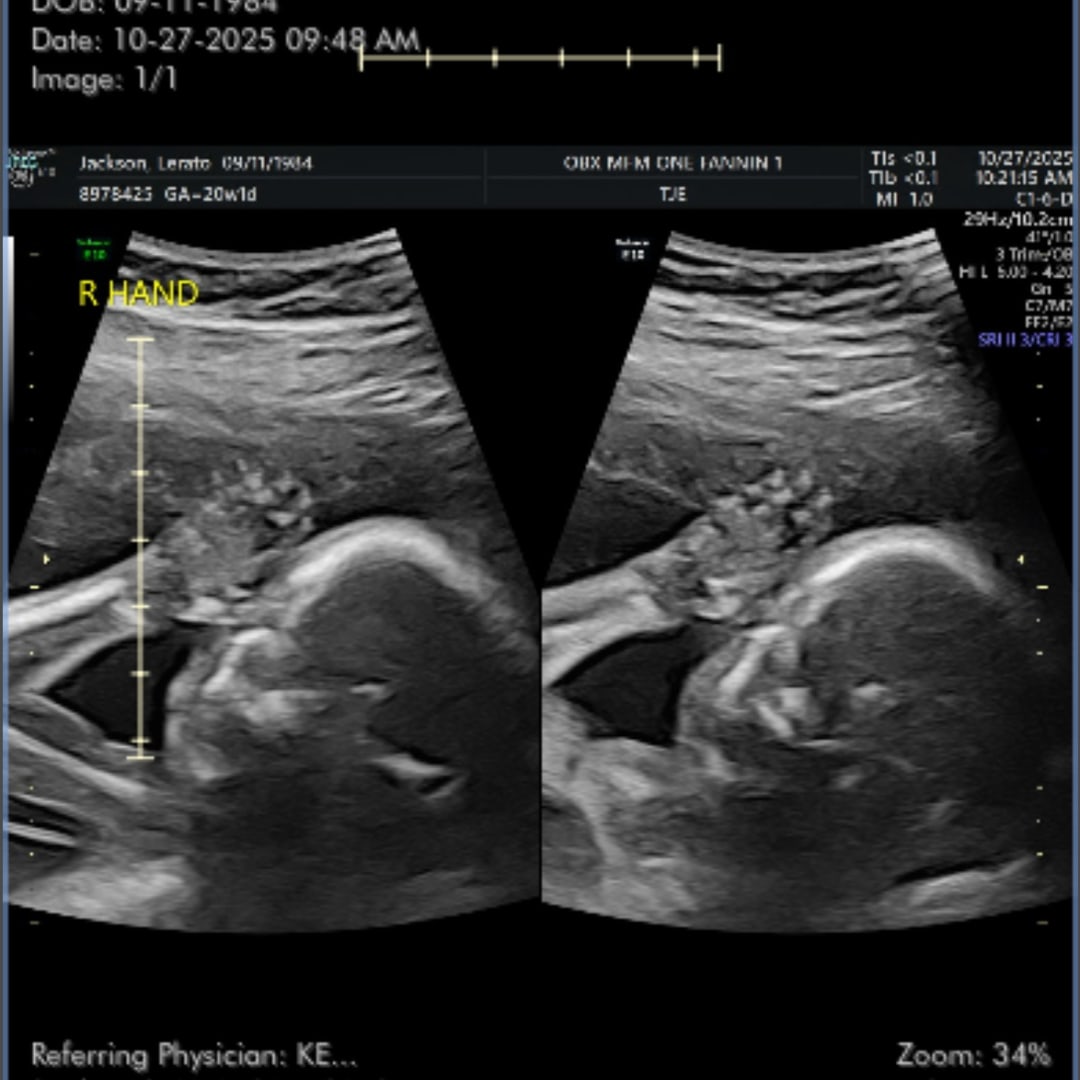 Photo shared by Lerato for their Babylist baby registry.