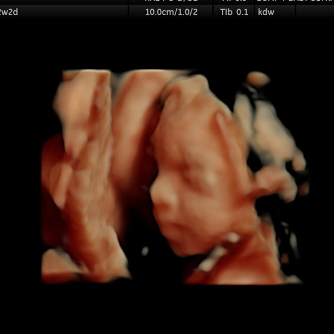 Photo shared by Lexi for their Babylist baby registry.