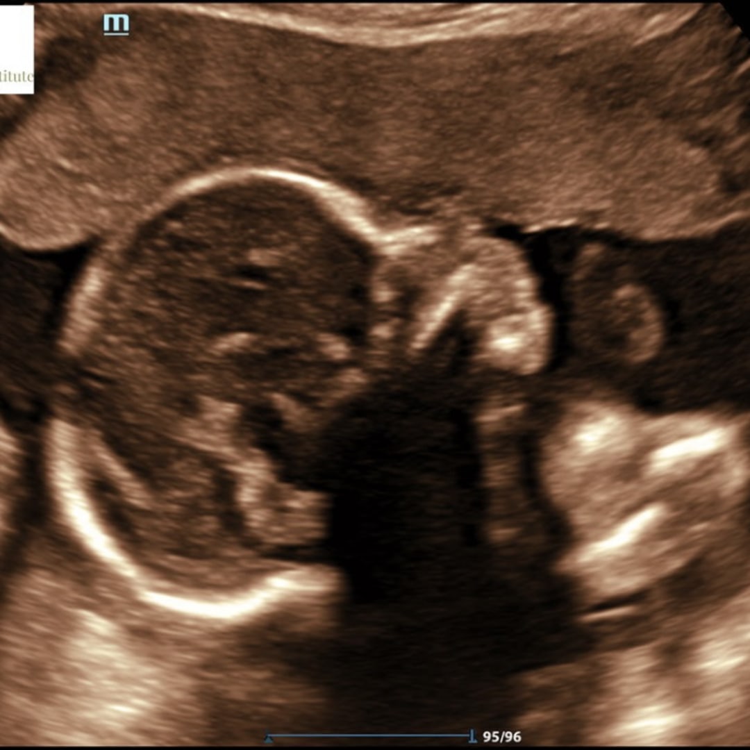 Photo shared by Clarisa for their Babylist baby registry.