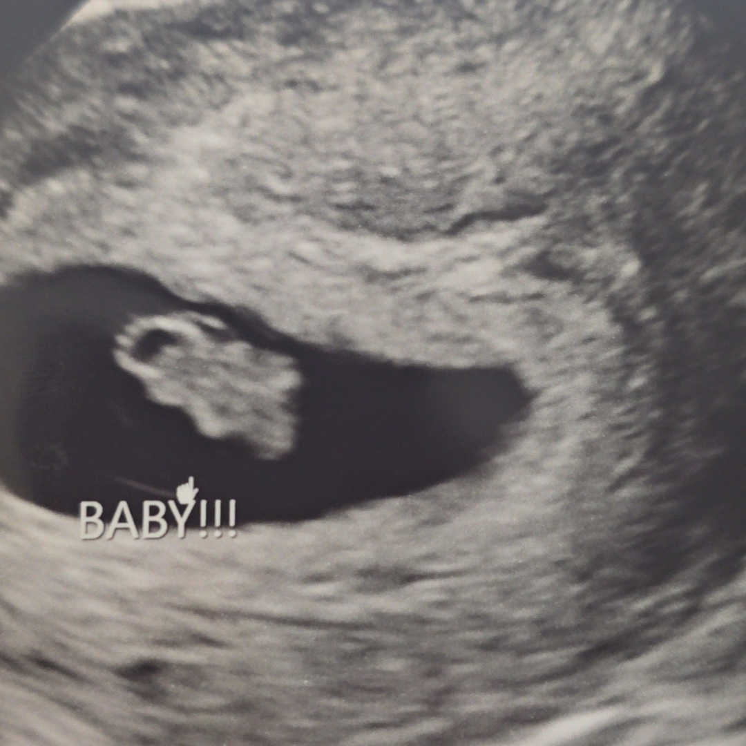 Photo shared by Candice for their Babylist baby registry.