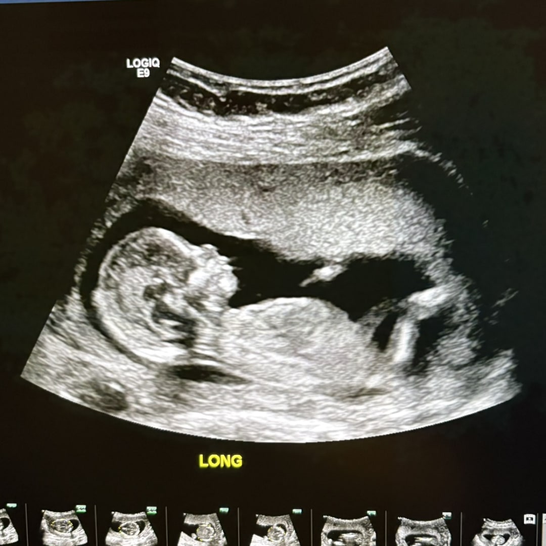 Photo shared by Breana for their Babylist baby registry.