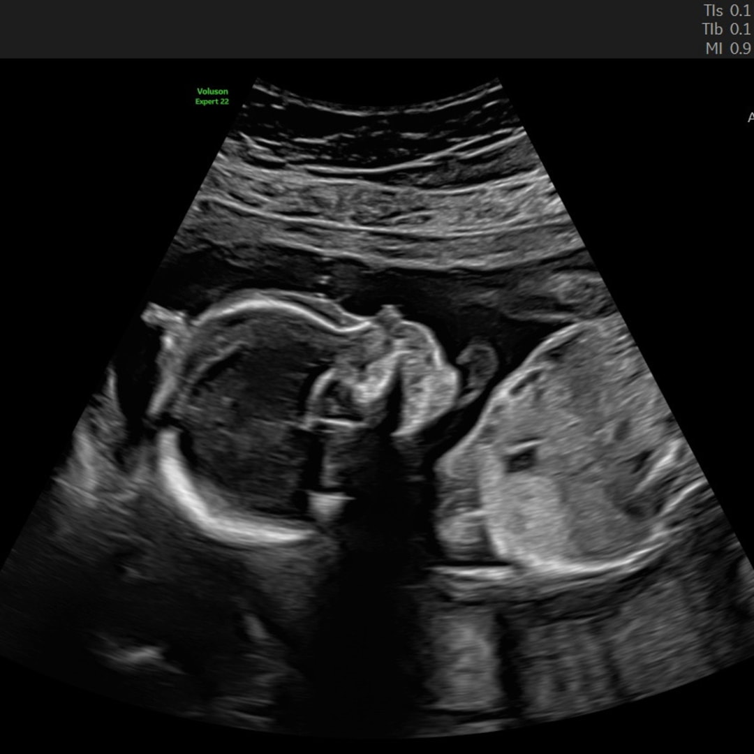 Photo shared by Heather for their Babylist baby registry.