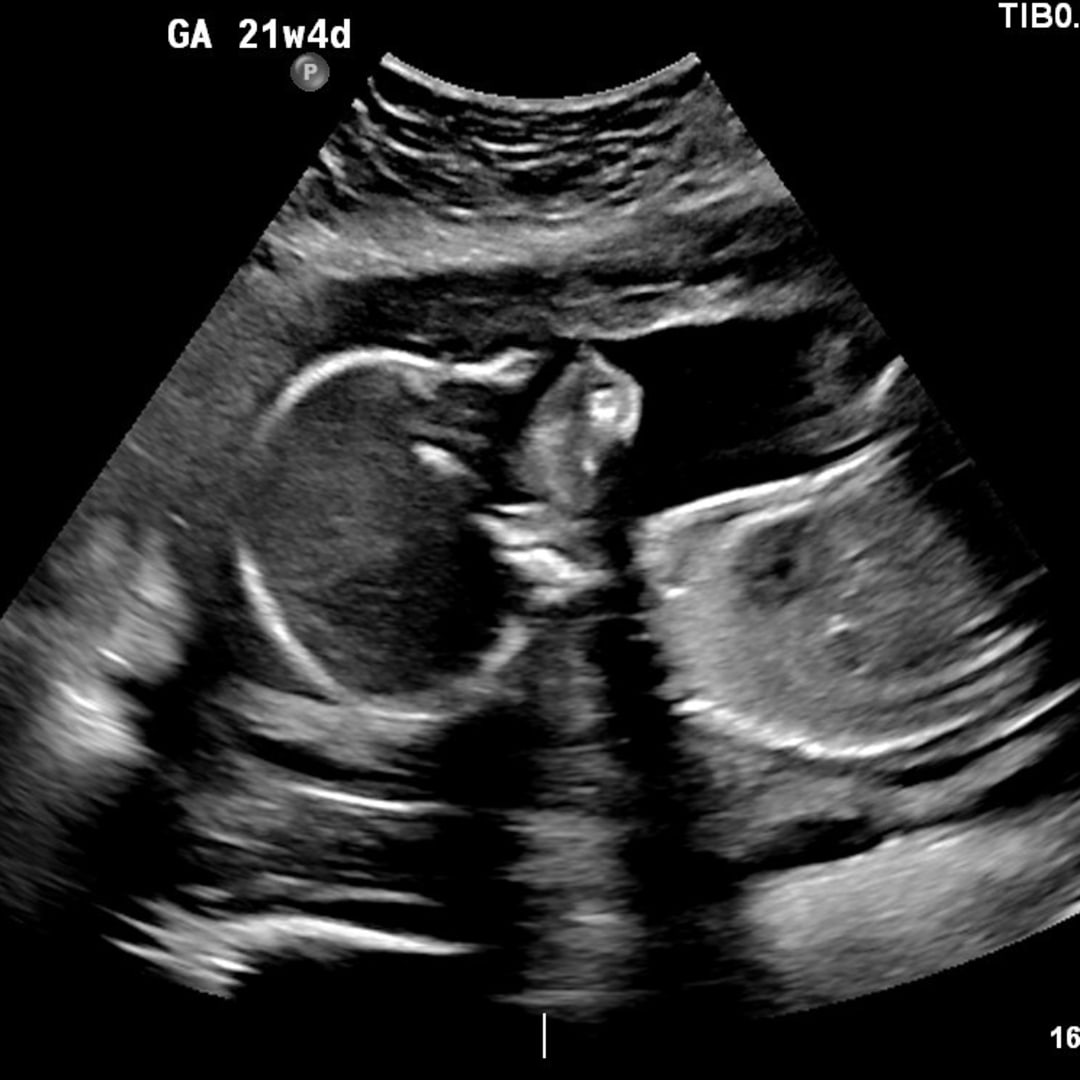 Photo shared by Hannah for their Babylist baby registry.