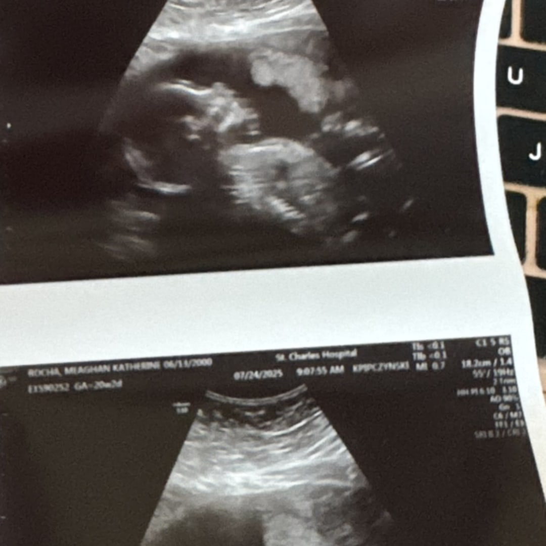 Photo shared by Meaghan for their Babylist baby registry.