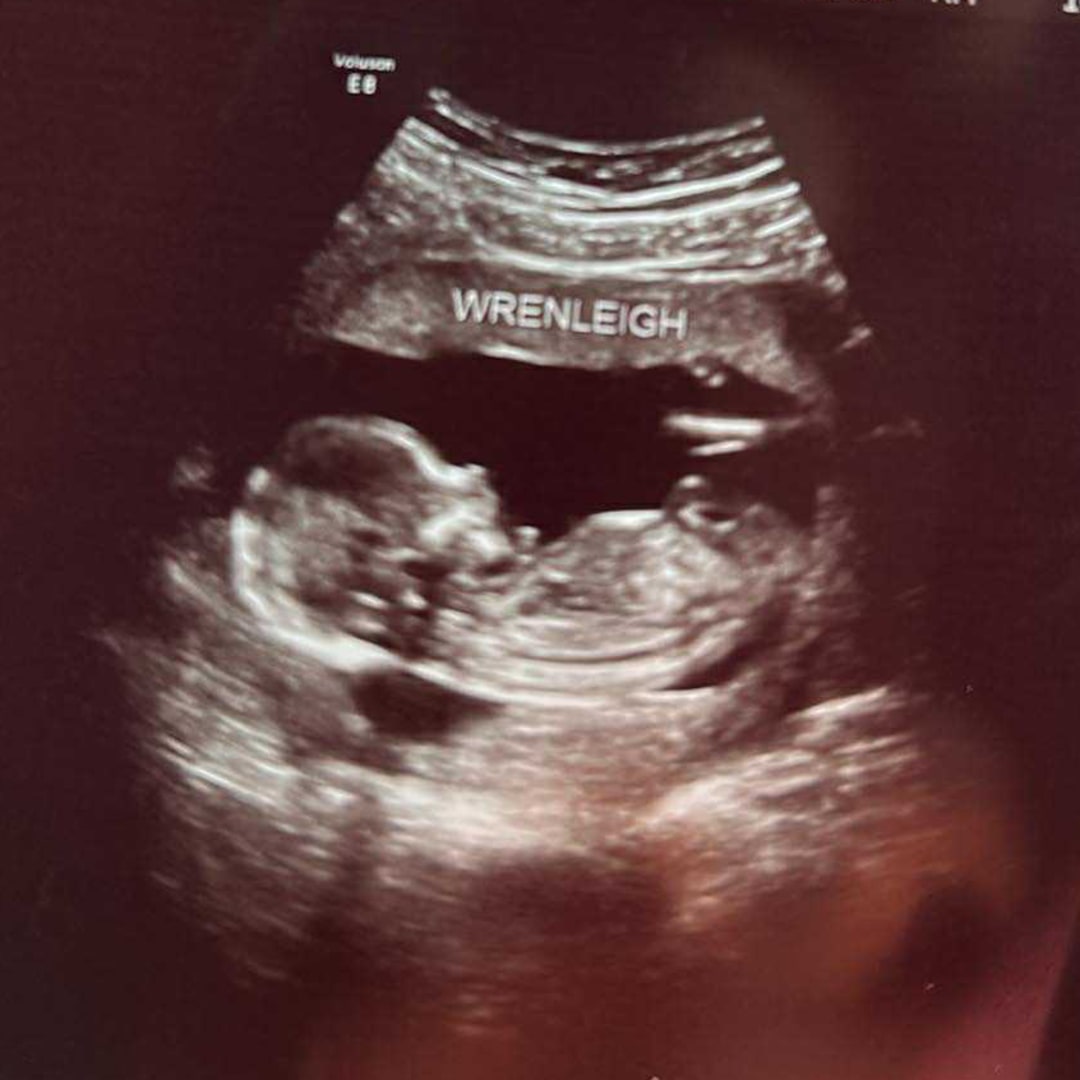 Photo shared by Makenna for their Babylist baby registry.