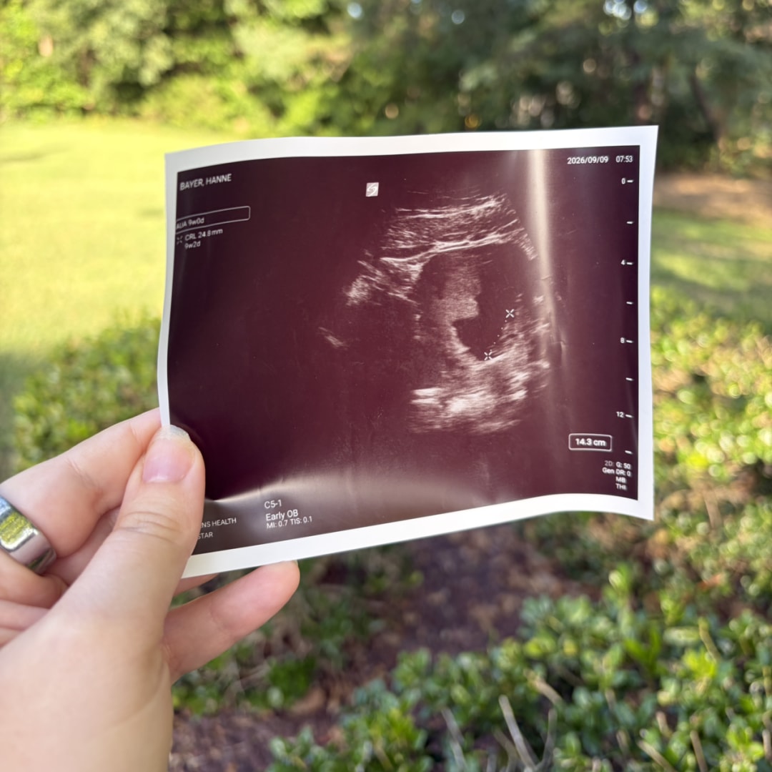Photo shared by Hanne for their Babylist baby registry.