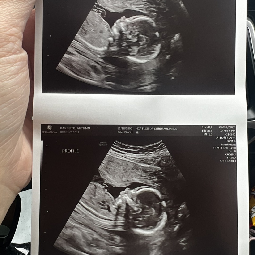 Photo shared by Autumn for their Babylist baby registry.