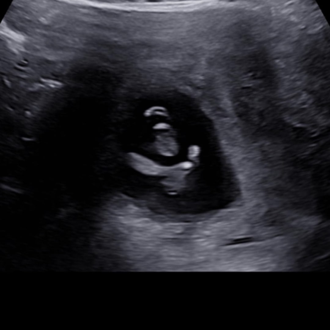 Photo shared by Dominique for their Babylist baby registry.