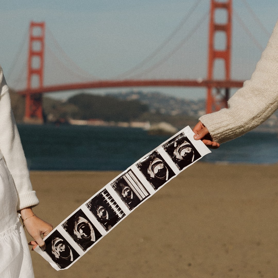 Photo shared by Kenzie & Hunter for their Babylist baby registry.