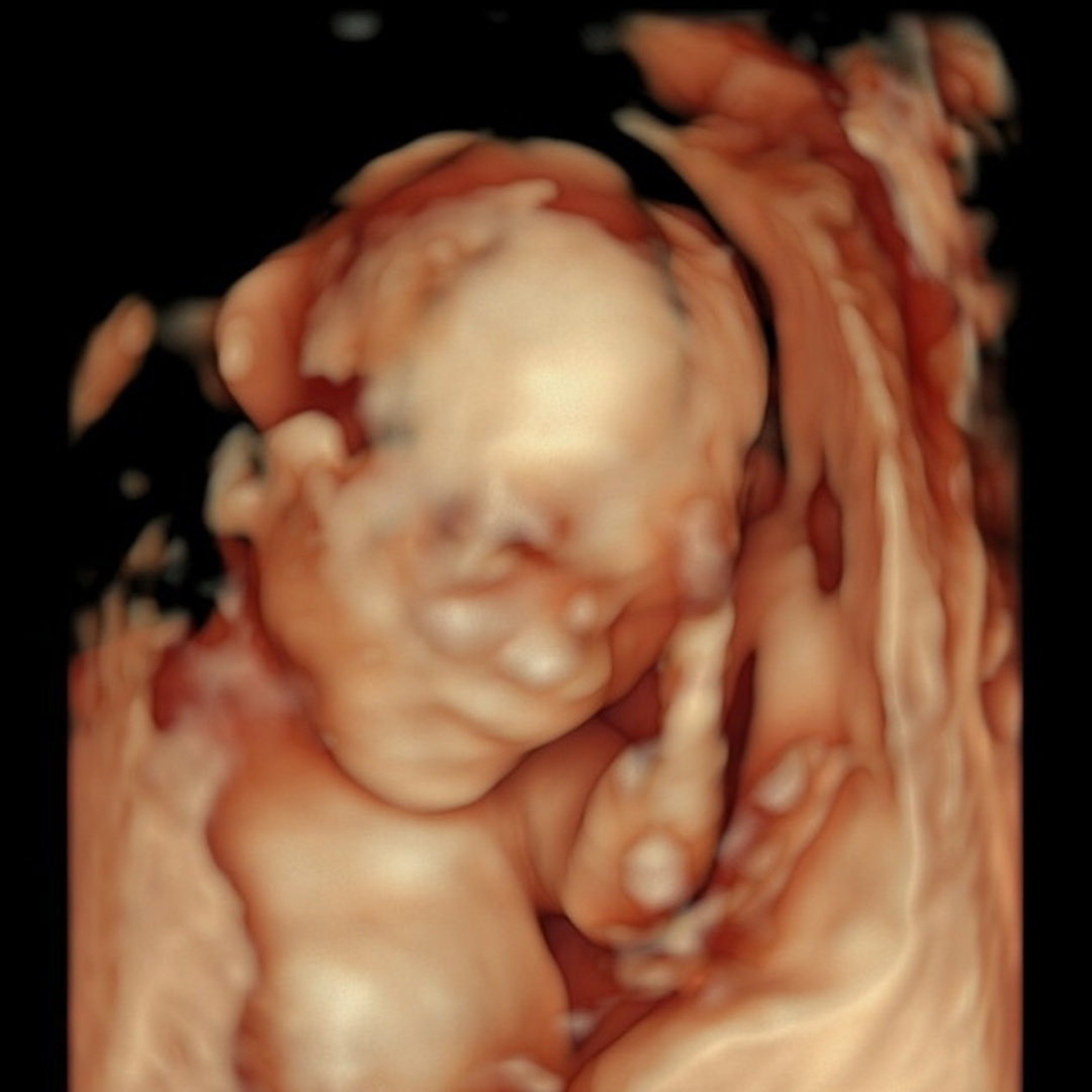 Photo shared by Beatrix Dawn for their Babylist baby registry.