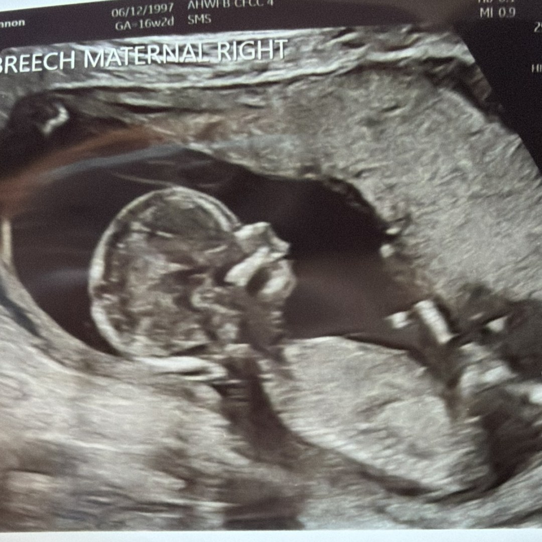 Photo shared by Amber for their Babylist baby registry.