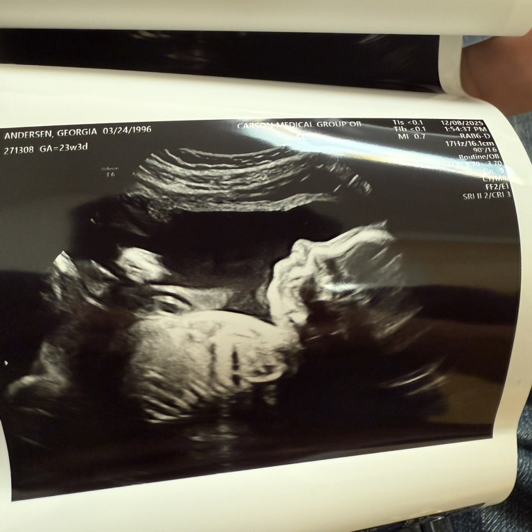 Photo shared by Georgia for their Babylist baby registry.