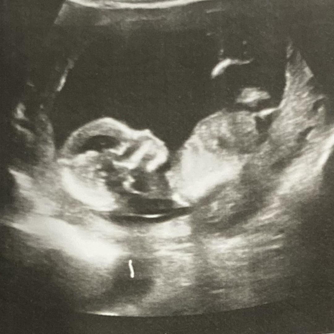 Photo shared by Filomena for their Babylist baby registry.