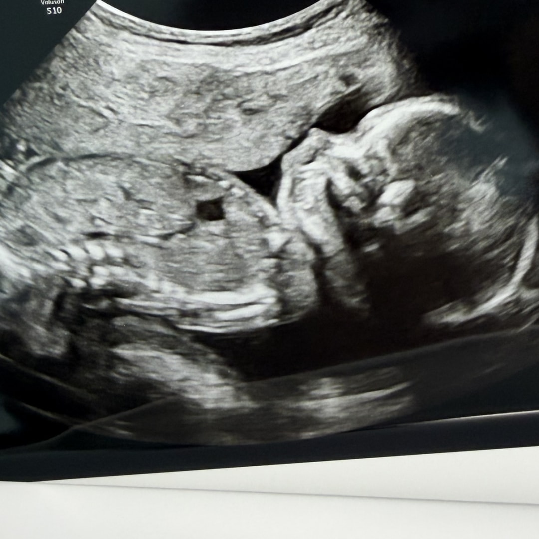 Photo shared by Breeann for their Babylist baby registry.