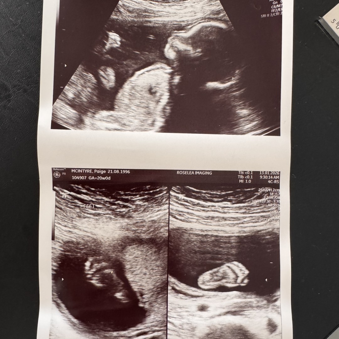 Photo shared by Paige for their Babylist baby registry.