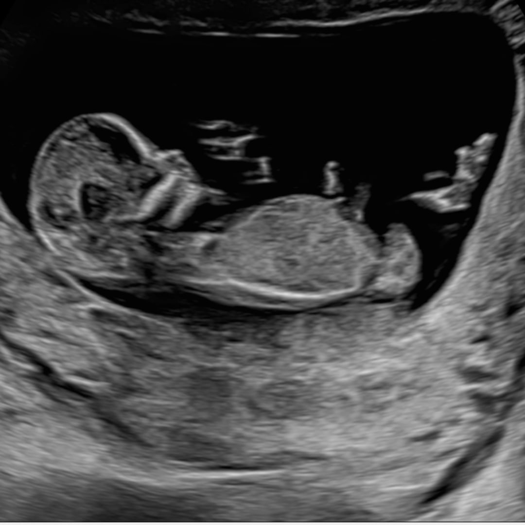 Photo shared by Ashlee for their Babylist baby registry.