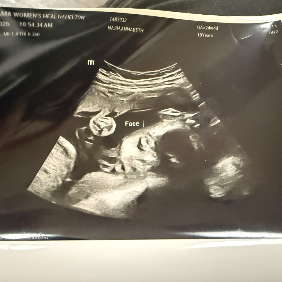 Photo shared by Annabeth for their Babylist baby registry.