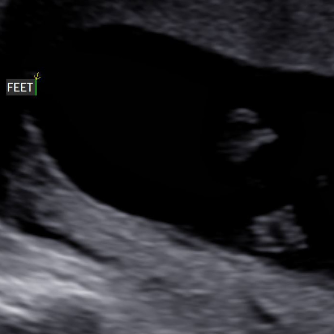 Photo shared by Shelbie for their Babylist baby registry.