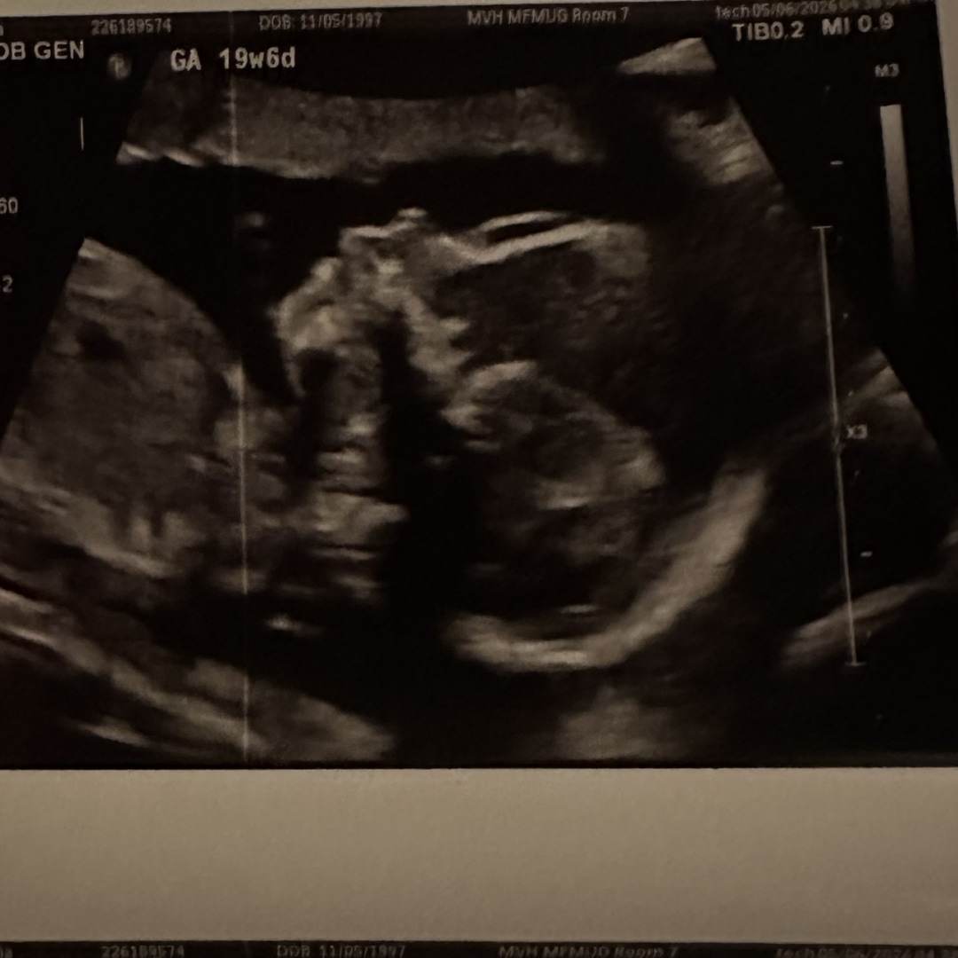 Photo shared by Olivia for their Babylist baby registry.