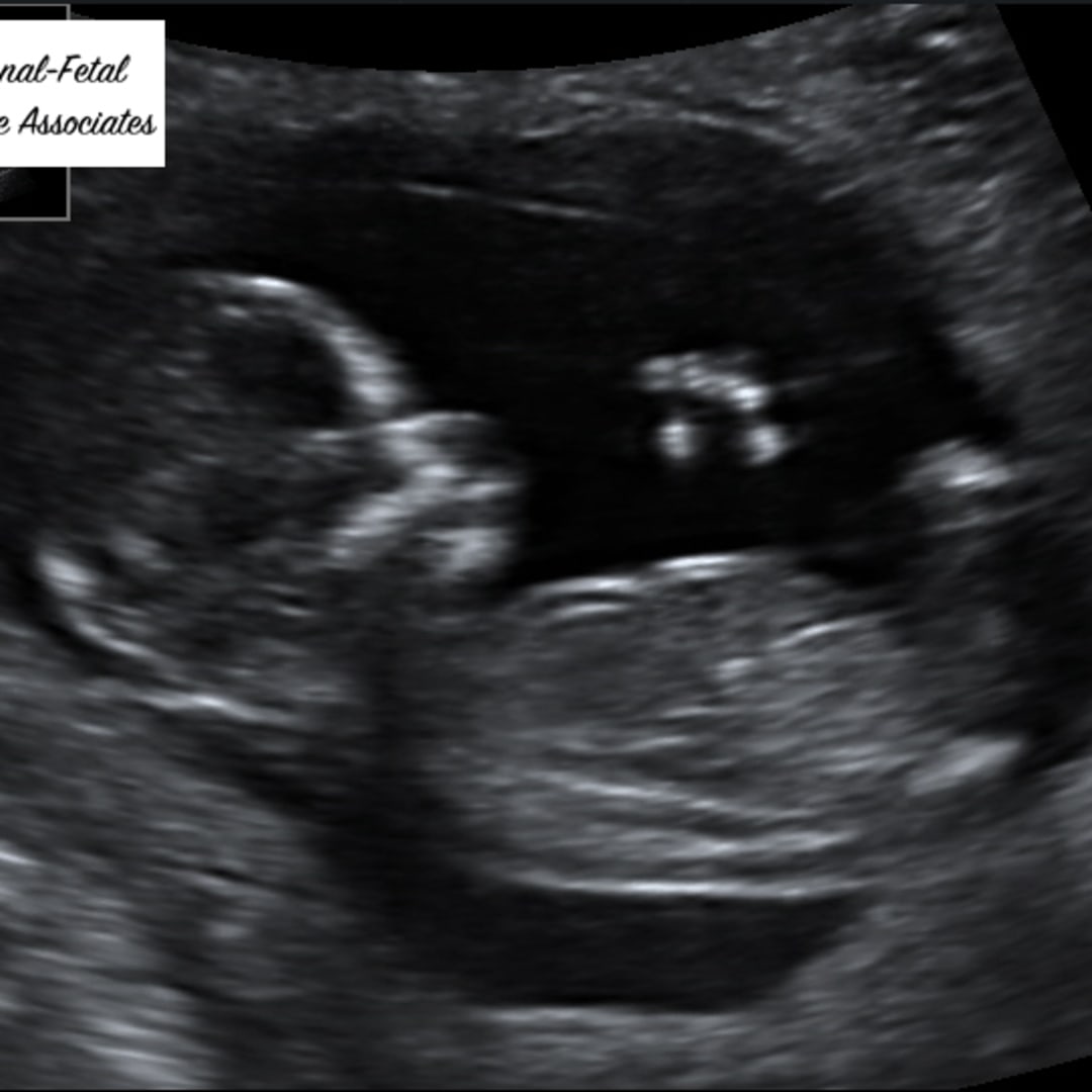 Photo shared by Cinthya for their Babylist baby registry.