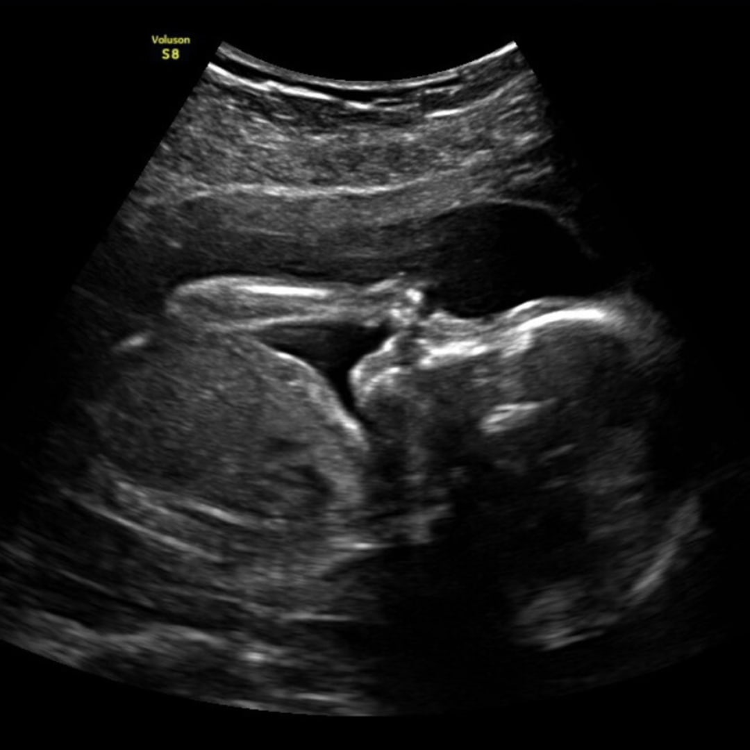 Photo shared by Emily for their Babylist baby registry.