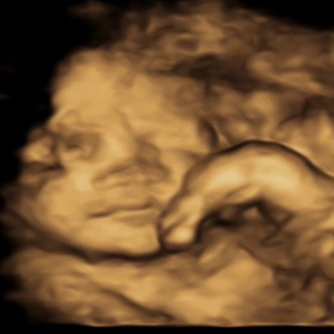 Photo shared by Marjorie for their Babylist baby registry.