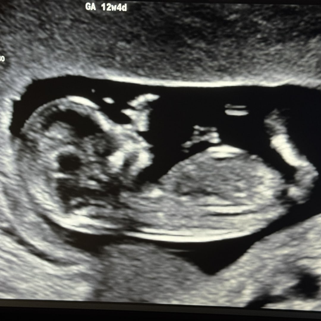 Photo shared by Rachel for their Babylist baby registry.