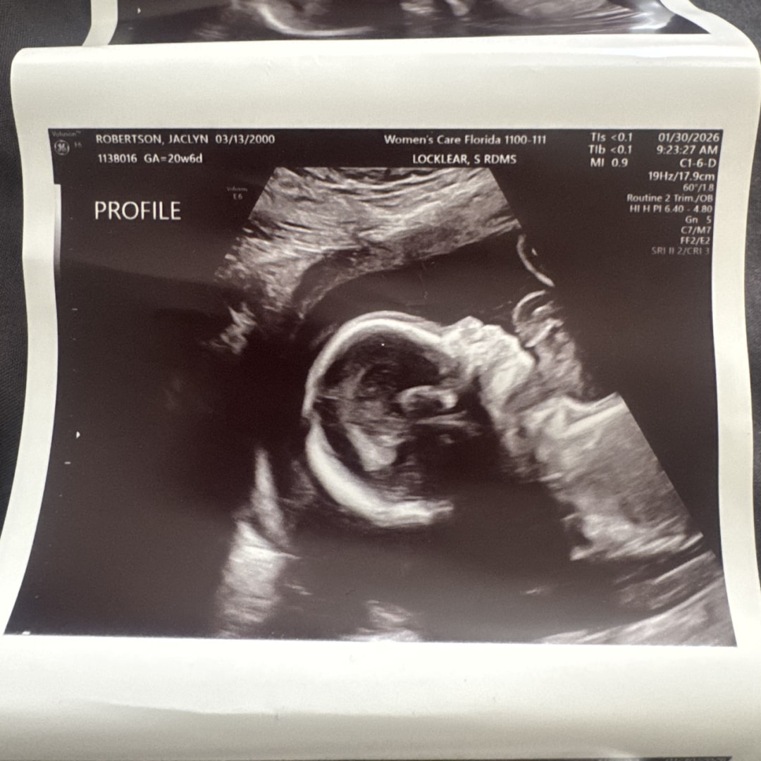 Photo shared by Jaclyn for their Babylist baby registry.