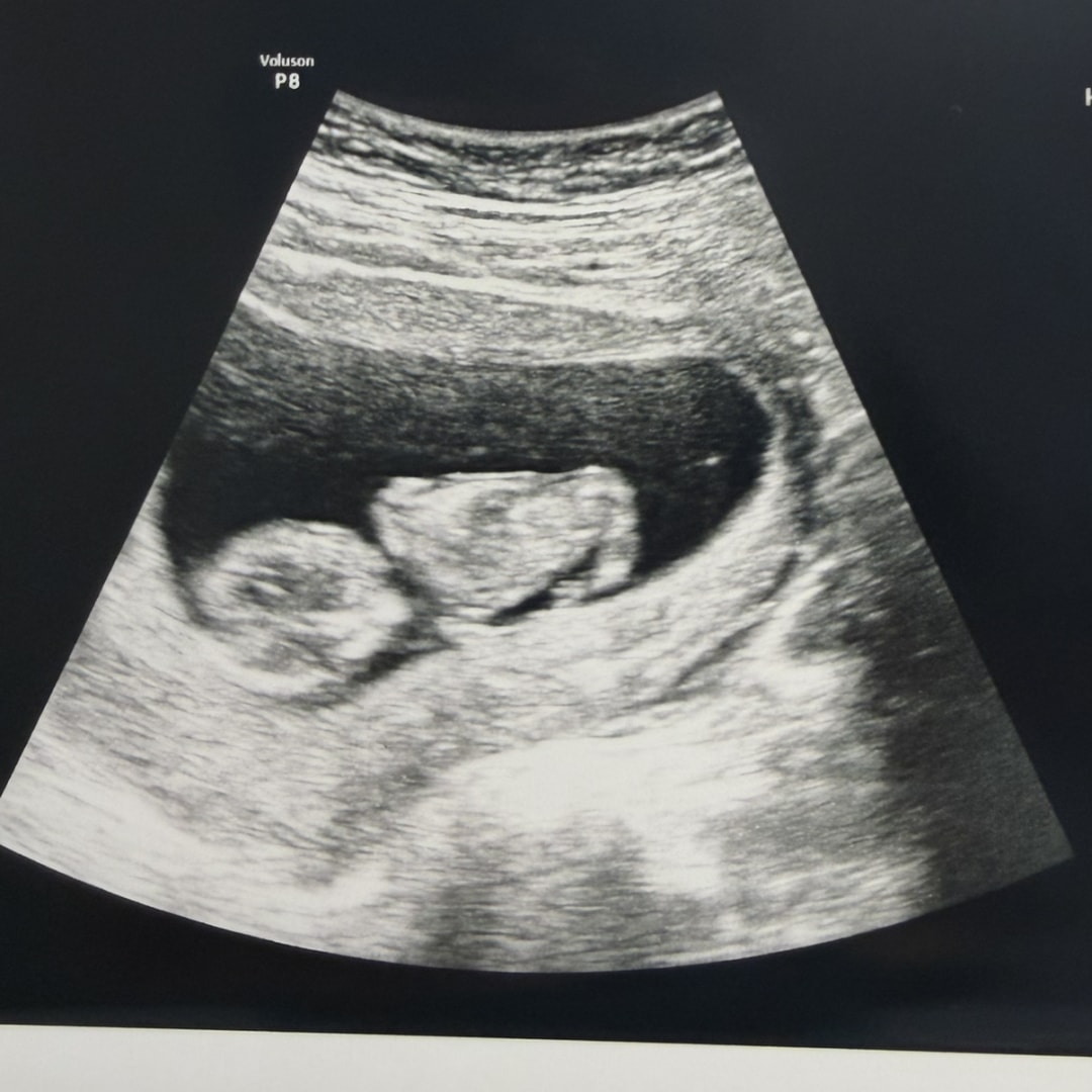 Photo shared by Katie & for their Babylist baby registry.