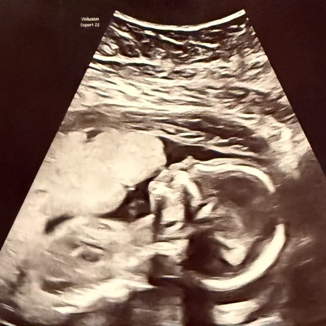 Photo shared by Jenna for their Babylist baby registry.