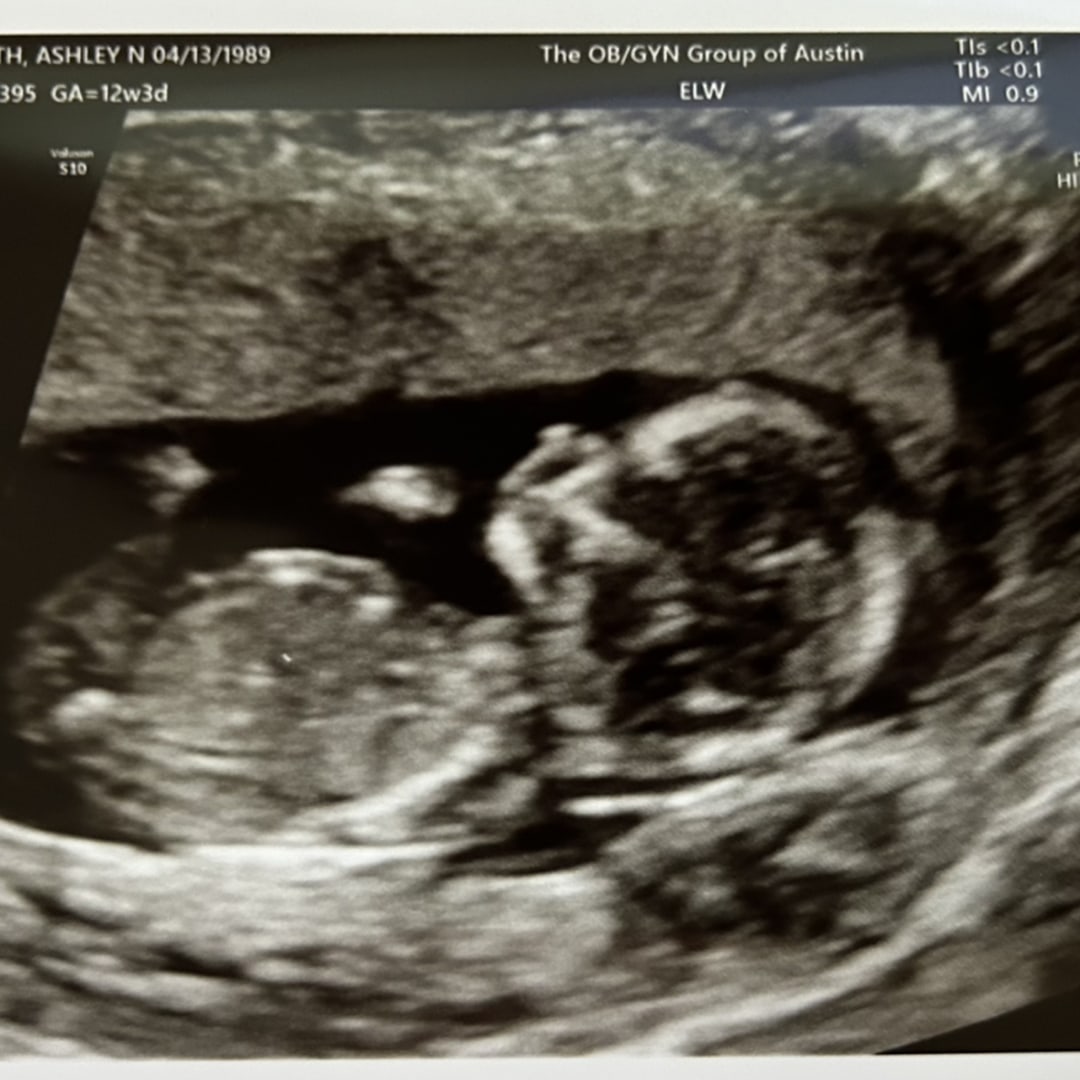 Photo shared by Ashley for their Babylist baby registry.