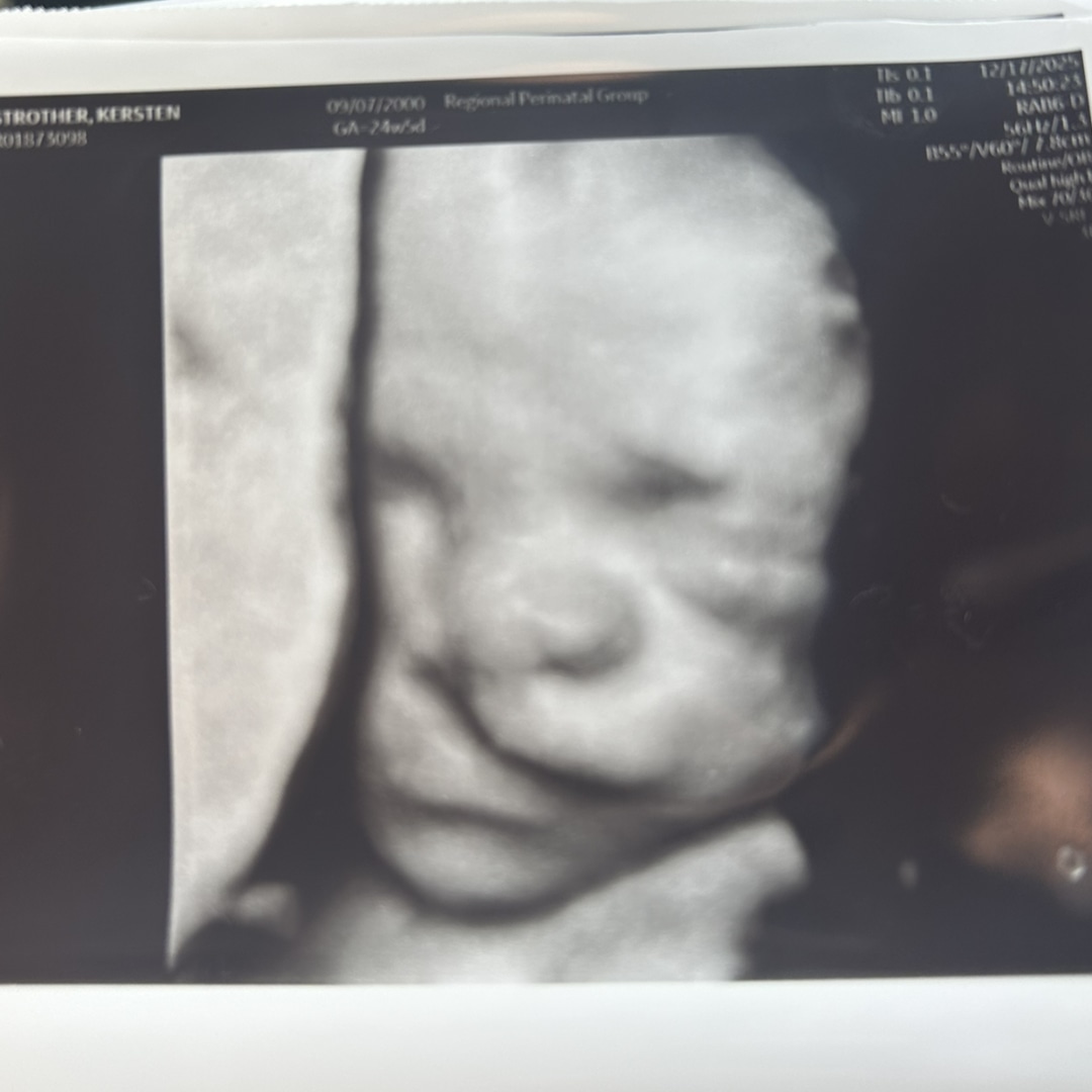 Photo shared by Kersten for their Babylist baby registry.