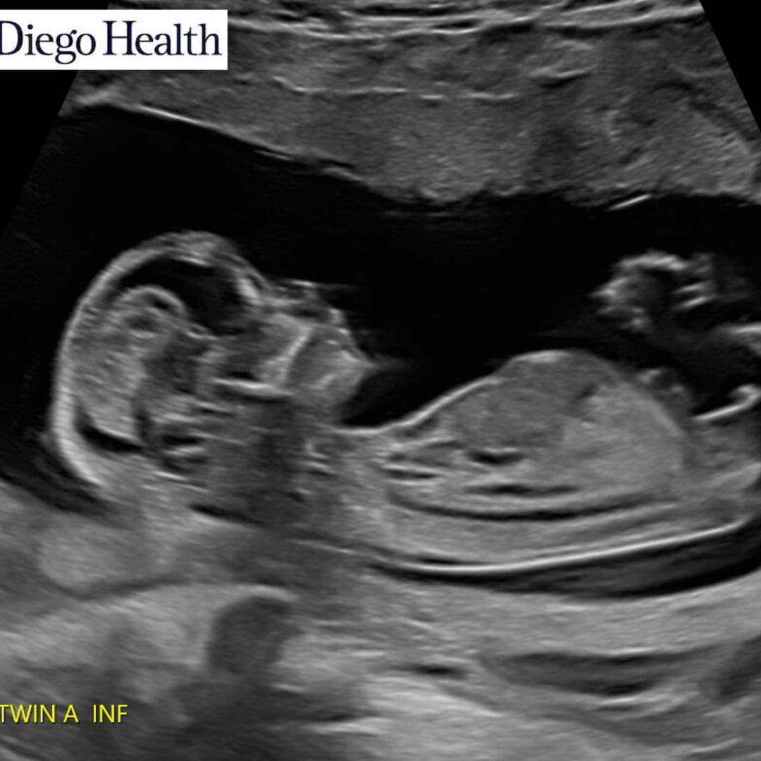 Photo shared by Lizbeth for their Babylist baby registry.