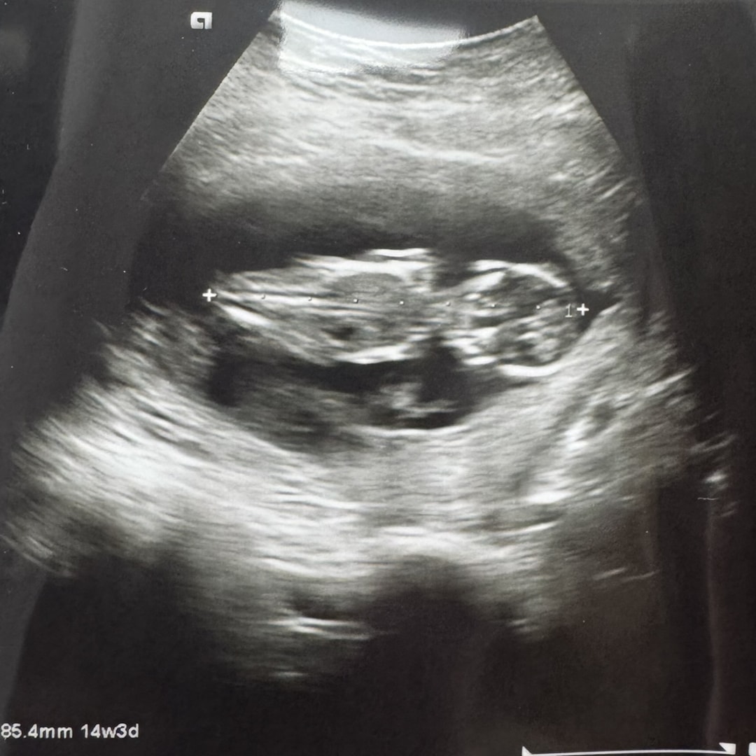 Photo shared by Haley for their Babylist baby registry.