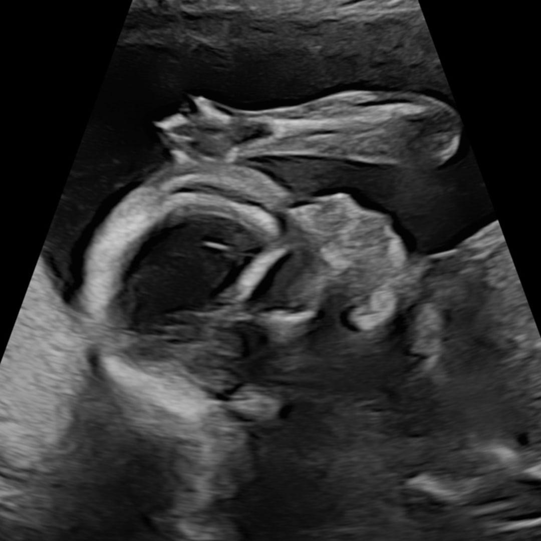 Photo shared by Bella for their Babylist baby registry.